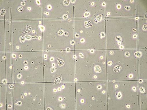 なぜ培養細胞は「老ける」のか｜直径22.3μmと14.9μmの実測データ
